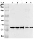 Western blot analysis was performed using anti-SRSF3 polyclonal antibody at 1ug/mL on various samples.
Lane 1: Mouse brain lysate
Lane 2: Mouse liver lysate
Lane 3: Mouse testis lysate
Lane 4: Rat brain lysate
Lane 5: Rat testis lysate