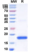 Recombinant Human TAF11 Protein, N-His