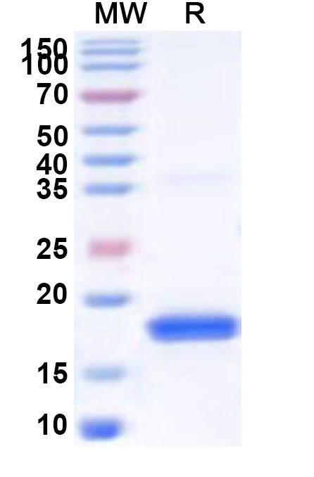 Recombinant Human TAF11 Protein, N-His