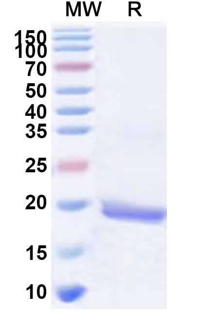 Recombinant Human RPL36A Protein, N-His