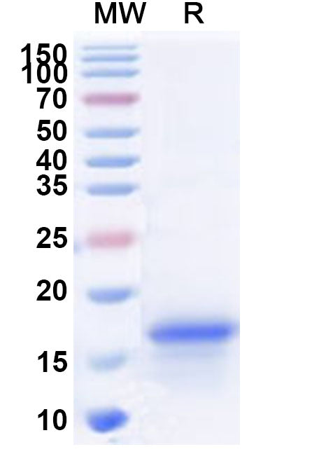 Recombinant Human SNRPD3 Protein, N-His