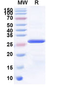 Recombinant Human MPP7 Protein, N-His