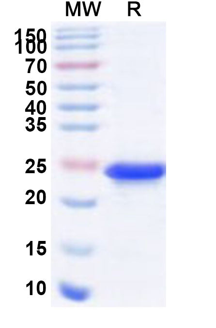 Recombinant Human TAF7 Protein, N-His