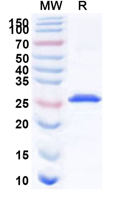 Recombinant Human NAB1 Protein, N-His