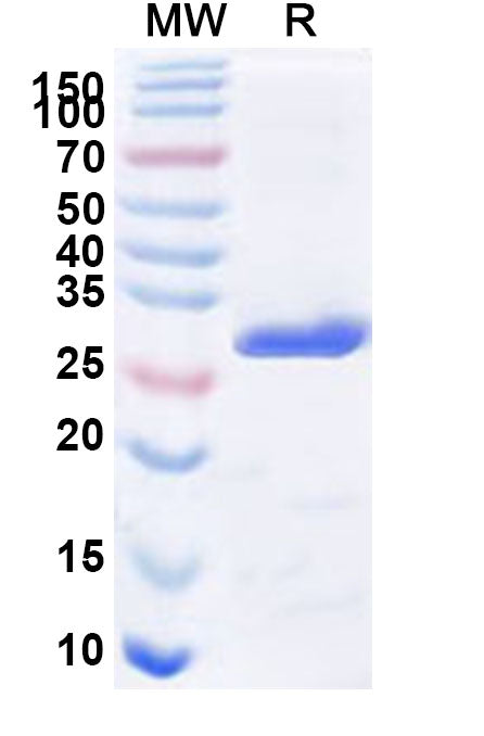 Recombinant Human PSME1 Protein, N-His