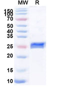 Recombinant Human NSMF Protein, N-His