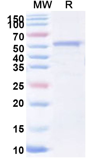 Recombinant Human GPS2 Protein, N-His-KSI