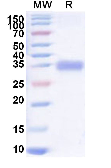 Recombinant Human SPRR1A Protein, N-His-KSI