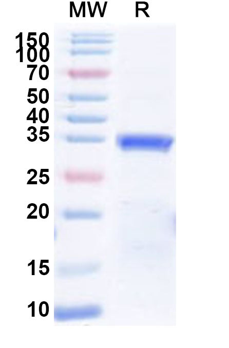 Recombinant Human PAX3 Protein, N-His