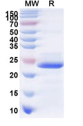 Recombinant Human SLC39A5 Protein, N-His