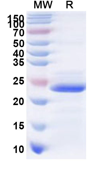 Recombinant Human SLC39A5 Protein, N-His