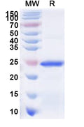 Recombinant Human BNC2 Protein, N-His