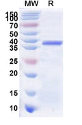 Recombinant Human ZNF322 Protein, N-His