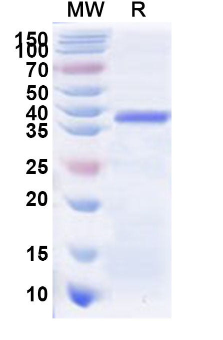 Recombinant Human ZNF322 Protein, N-His