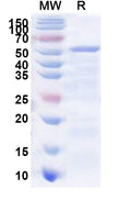 Recombinant Human GALNT18 Protein, N-His