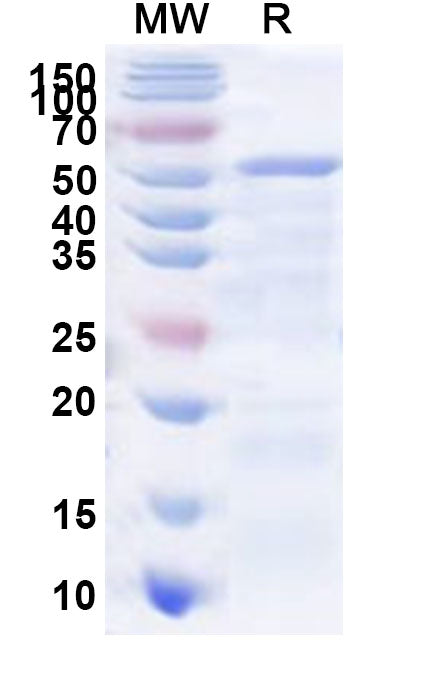 Recombinant Human GALNT18 Protein, N-His