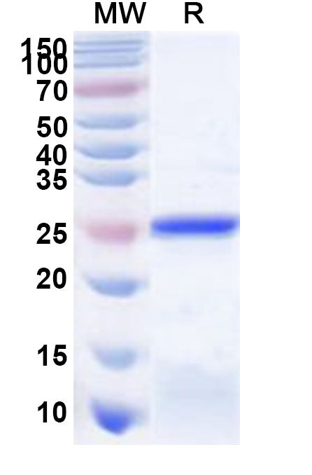Recombinant Human IYD Protein, N-His
