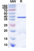 Recombinant Human DMGDH Protein, N-His