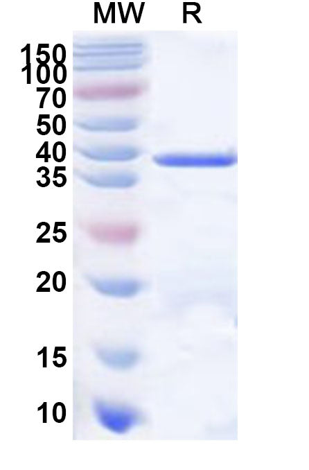 Recombinant Human DMGDH Protein, N-His