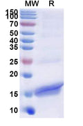 Recombinant Human NCR2 Protein, N-His