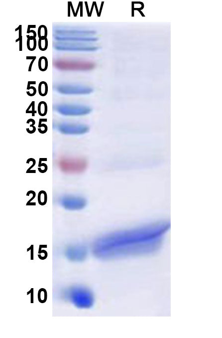Recombinant Human NCR2 Protein, N-His