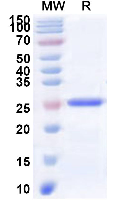 Recombinant Human PACC1 Protein, N-His