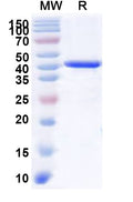 Recombinant Human CDK18 Protein, N-His