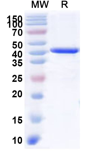 Recombinant Human CDK18 Protein, N-His