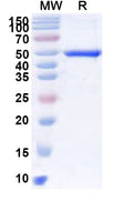 Recombinant Human MGAT3 Protein, N-His
