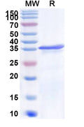 Recombinant Human ST3GAL4 Protein, N-His