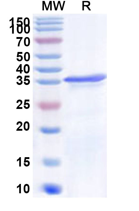 Recombinant Human ST3GAL4 Protein, N-His