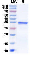 Recombinant Human ST3GAL1 Protein, N-His