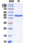 Recombinant Human MGAT2 Protein, N-His