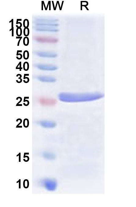 Recombinant Human PKIA Protein, N-His-KSI