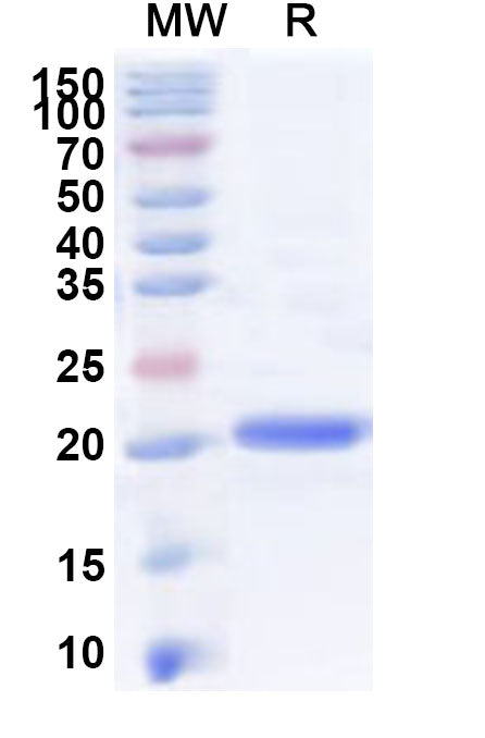 Recombinant Human MTO1 Protein, N-His