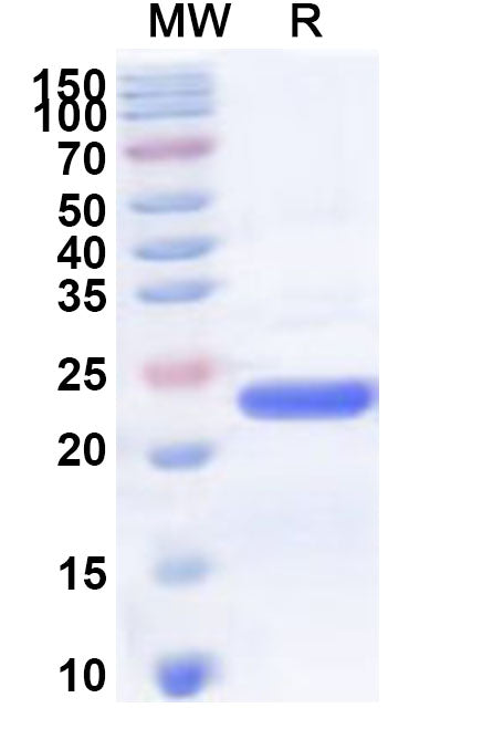 Recombinant Human ATP5F1E Protein, N-His-KSI
