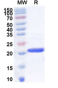 Recombinant Human VBP1 Protein, N-His