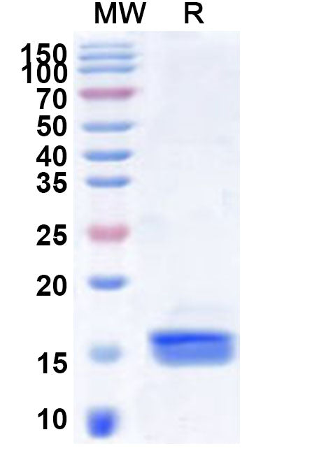Recombinant Human GPD2 Protein, N-His