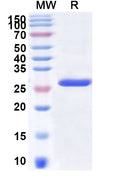 Recombinant Human GHITM Protein, N-His-KSI
