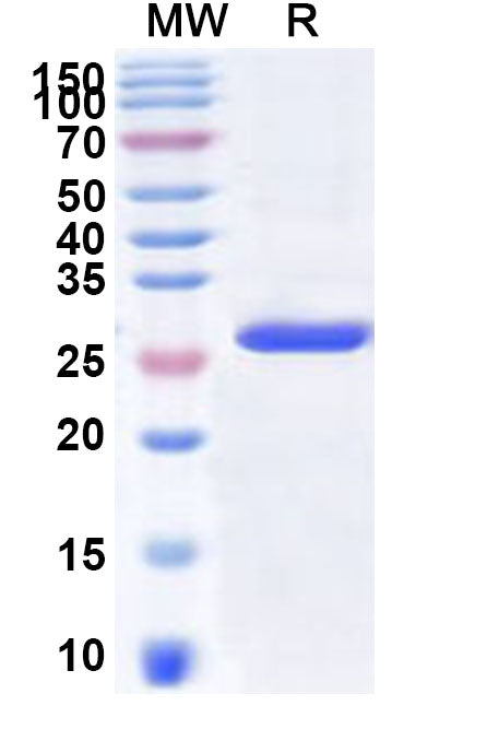 Recombinant Human GHITM Protein, N-His-KSI