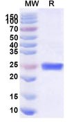 Recombinant Human SF3B4 Protein, N-His