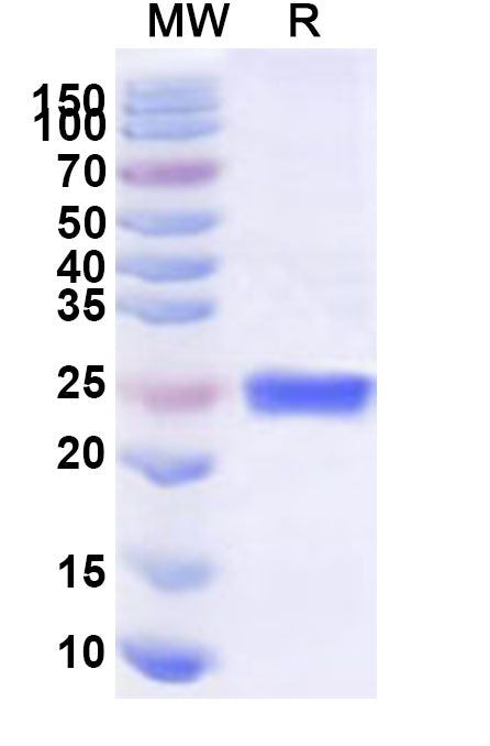 Recombinant Human SF3B4 Protein, N-His
