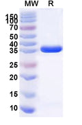 Recombinant Human ALYREF Protein, N-GST & C-His