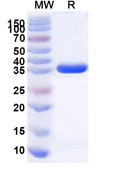 Recombinant Human ALYREF Protein, N-GST & C-His