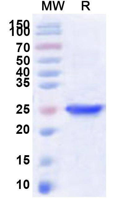 Recombinant Human AVPR1B Protein, N-His-KSI