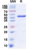 Recombinant Human NOP2 Protein, N-His