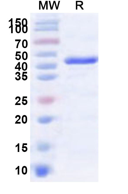 Recombinant Human NOP2 Protein, N-His