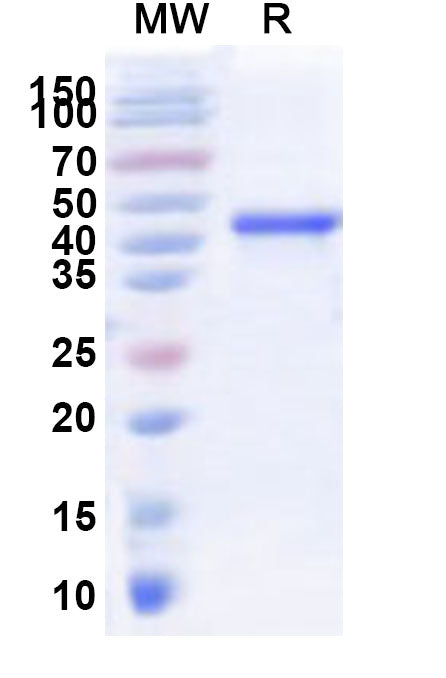 Recombinant Human NRL Protein, N-His-KSI