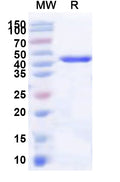 Recombinant Human FMN1 Protein, N-His