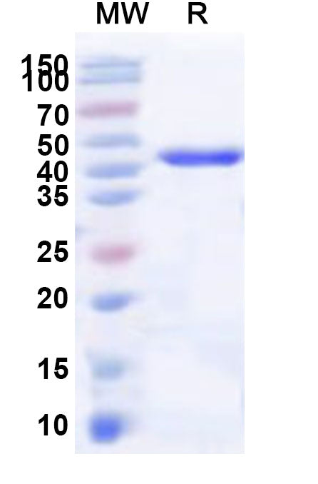 Recombinant Human FMN1 Protein, N-His